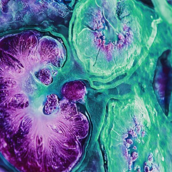 Emerald Clinical Brings Robust Retention Strategy and Tactics to Global Rare Renal Disease Studies